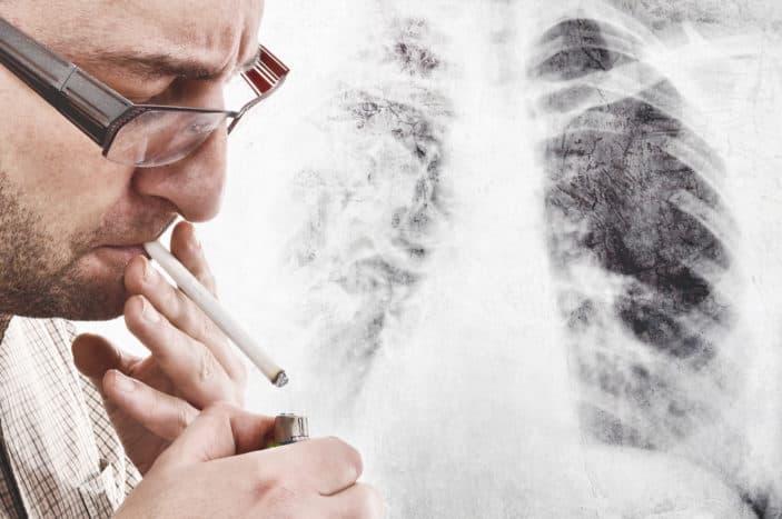 symptomer på lungekræft