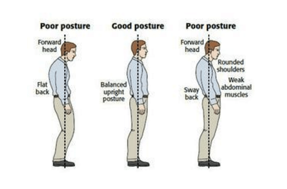 Billedkilde: http://www.thephysiocompany.com/blog/stop-slouching-postural-dysfunction-symptoms-causes-and-behandling-of-bad-posture