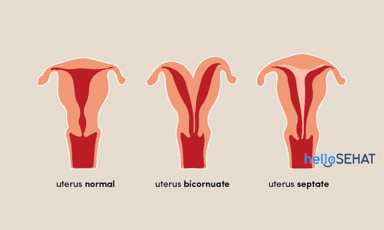 abnormiteter i livmoderen