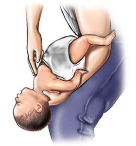 Skridt til at hjælpe kvælning babyer (4-5) kilde: www.webmd.com