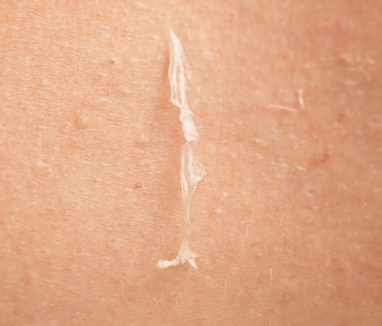 årsager til at overvinde peeling hud