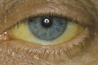 gule øjne