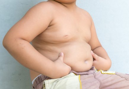 fedme hos børn