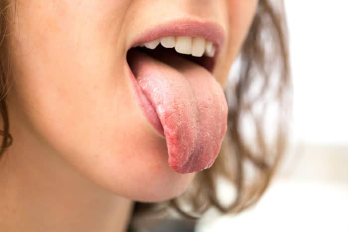 årsagen til tunge kløe