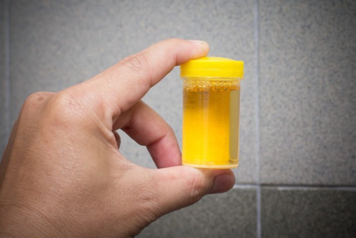 urinterapi til at drikke urin