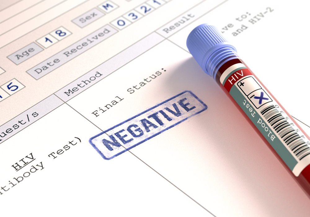 betydningen af ​​resultaterne af en negativ hiv-test
