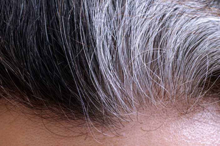 årsager til graying skamhår