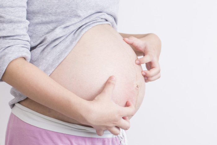 Pruritic folliculitis er årsagen til kløende hud under graviditeten