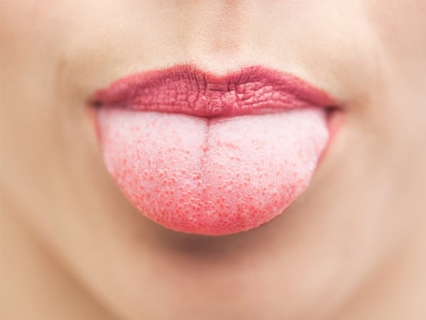 tungenes farve betyder sygdom